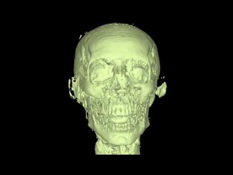 momia-escaner